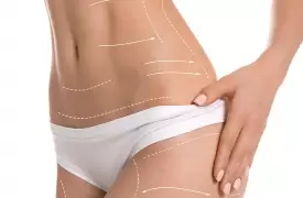 Marcación abdominal