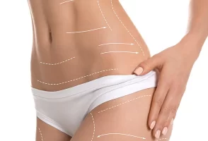 Marcación abdominal